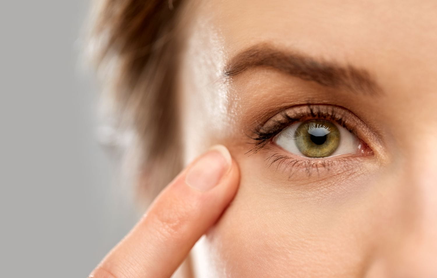 Chalazion