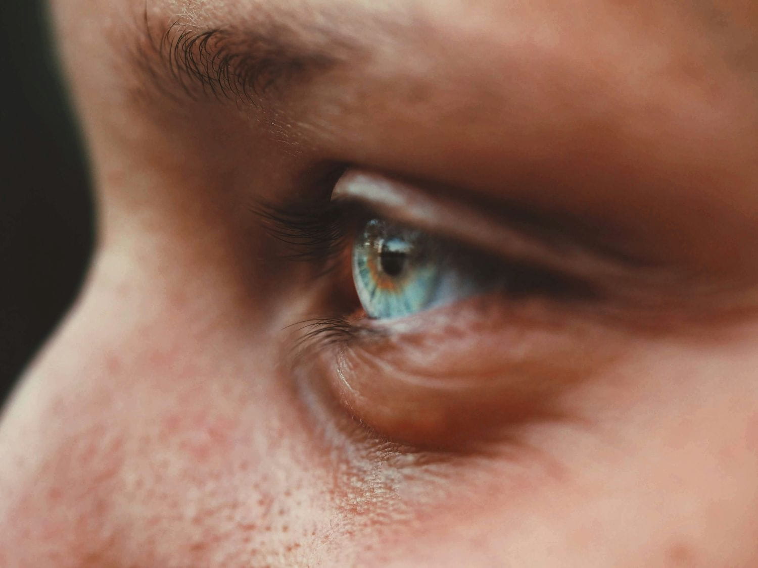 Chalazion Surgery