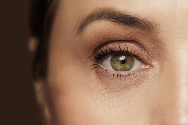 Blepharitis and Chalazion